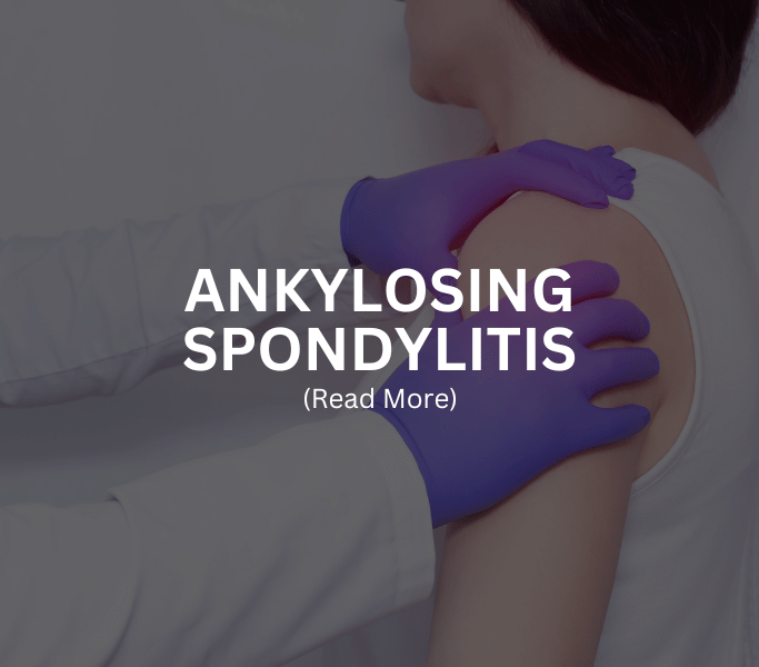 ANKYLOSING SPONDYLITIS Treatment at Arthritis Clinic of Cypress and Katy