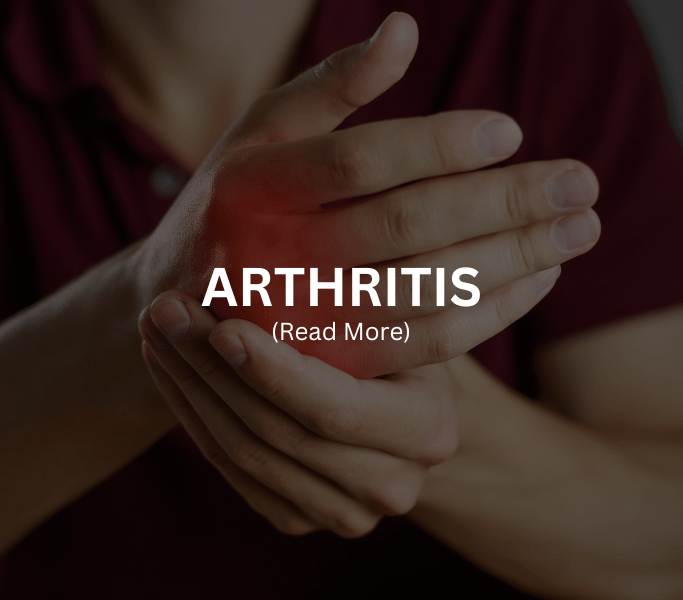 ARTHRITIS Diseases Treated at Arthritis Clinic of Cypress and Katy