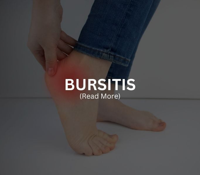 BURSITIS Treatment at Arthritis Clinic of Cypress and Katy