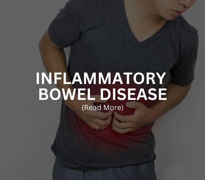 INFLAMMATORY BOWEL DISEASE Treatment at Arthritis Clinic of Cypress and Katy