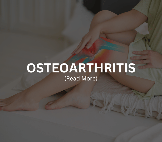 Osteoarthritis Treatment at Arthritis Clinic of Cypress and Katy