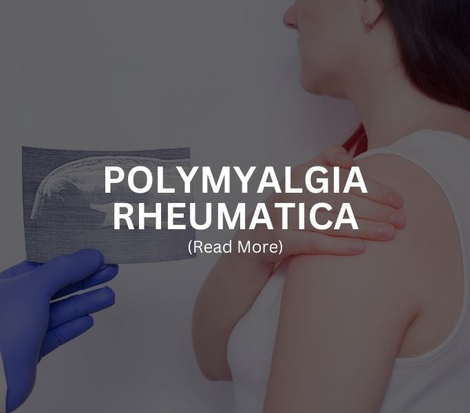 POLYMYALGIA RHEUMATICA Treatment at Arthritis Clinic of Cypress and Katy
