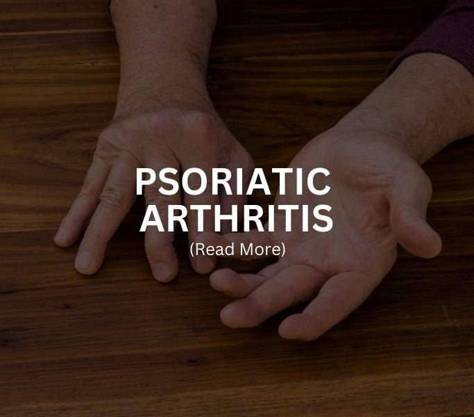 PSORIATIC ARTHRITIS