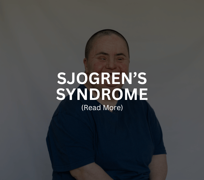 SJOGREN’S SYNDROME Treatment at Arthritis Clinic of Cypress and Katy
